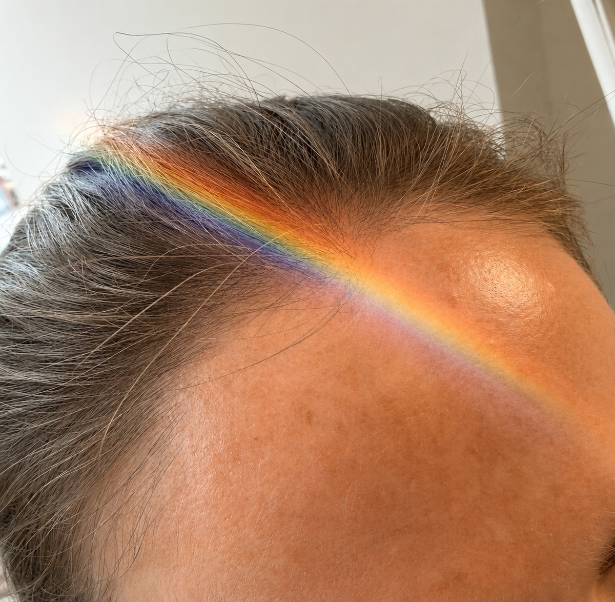 Sunlight split by a prism into a rainbow across a forehead and hairline